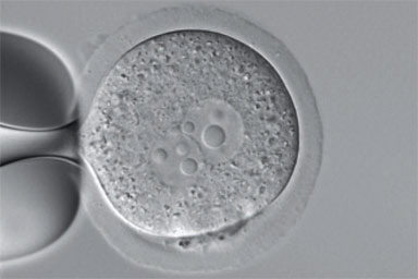 Transgenic Mouse Embryo